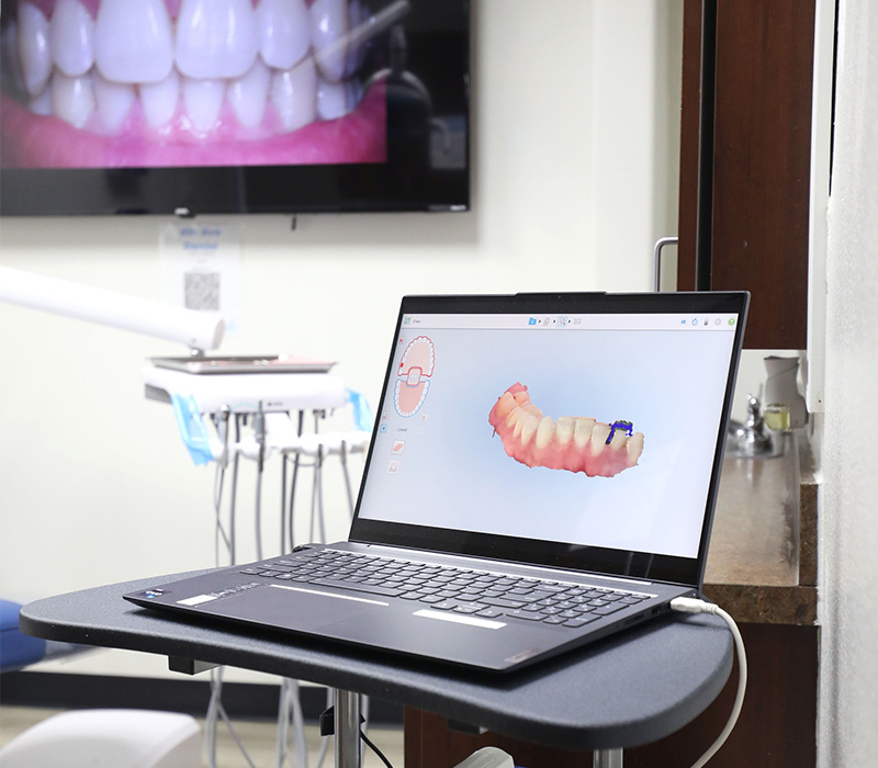 8th Avenue Dental Special Offer